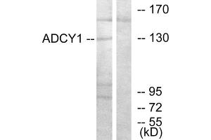 Western blot analysis of extracts from COLO205 cells, using ADCY1 antibody. (ADCY1 抗体  (Internal Region))