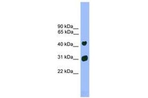 Image no. 1 for anti-LIM Homeobox 5 (LHX5) (AA 251-300) antibody (ABIN6744536) (LHX5 抗体  (AA 251-300))