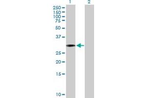 Western Blot analysis of SCML1 expression in transfected 293T cell line by SCML1 MaxPab polyclonal antibody. (SCML1 抗体  (AA 1-208))