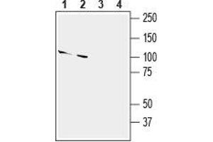 Western Blotting (WB) image for anti-SLIT and NTRK-Like Family, Member 2 (SLITRK2) (AA 301-315), (Extracellular) antibody (ABIN7043630)