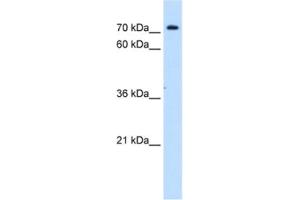 Western Blotting (WB) image for anti-Solute Carrier Family 5 (Sodium/inositol Cotransporter), Member 11 (SLC5A11) antibody (ABIN2462773) (Solute Carrier Family 5 (Sodium/inositol Cotransporter), Member 11 (SLC5A11) 抗体)
