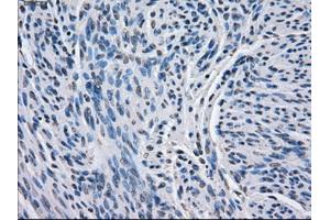 Immunohistochemical staining of paraffin-embedded endometrium tissue using anti-BCKDK mouse monoclonal antibody. (BCKDK 抗体)