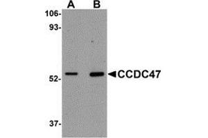 Western blot analysis of CCDC47 in mouse heart tissue lysate with AP30211PU-N CCDC47 antibody at (A) 1 and (B) 2 μg/ml. (CCDC47 抗体  (C-Term))