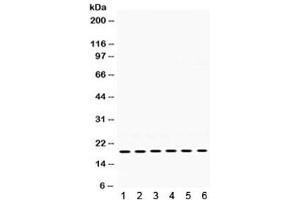 Western blot testing of 1) rat skeletal muscle, 2) rat thymus, 3) mouse brain, 4) mouse thymus, 5) human 22RV1, and 6) human MCF7 lysate with PTP4A2 antibody. (PTP4A2 抗体)
