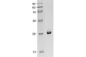 Western Blotting (WB) image for MYC Associated Factor X (MAX) (Transcript Variant 1) protein (His tag) (ABIN2725572)