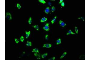 Immunofluorescence staining of SH-SY5Y cells with ABIN7167956 at 1:33, counter-stained with DAPI. (ARHGAP32 抗体  (AA 130-205))