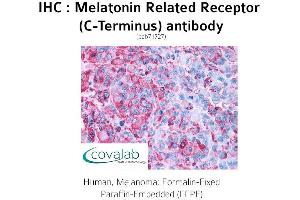Image no. 1 for anti-G Protein-Coupled Receptor 50 (GPR50) (C-Term) antibody (ABIN1736883) (GPR50 抗体  (C-Term))