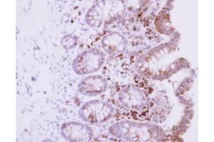 IHC-P Image Immunohistochemical analysis of paraffin-embedded human normal colon, using RPL15, antibody at 1:500 dilution. (RPL15 抗体)