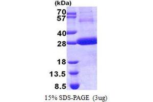 Cathepsin F Protein (CTSF) (AA 271-484) (His tag)