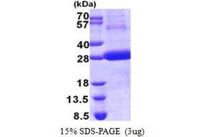 SDS-PAGE (SDS) image for Cathepsin F (CTSF) (AA 271-484) protein (His tag) (ABIN5853153) (Cathepsin F Protein (CTSF) (AA 271-484) (His tag))