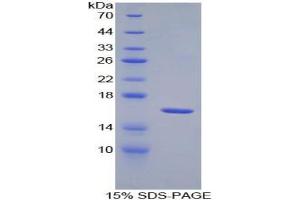 SDS-PAGE analysis of Mouse IL18R1 Protein. (IL18R1 蛋白)