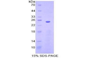 SDS-PAGE analysis of Mouse Sprouty Homolog 3 Protein. (SPRY3 蛋白)