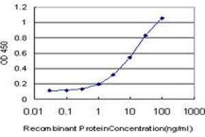 Detection limit for recombinant GST tagged LIMK1 is approximately 0. (LIM Domain Kinase 1 抗体  (AA 548-647))