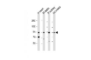 All lanes : Anti-PDE1C Antibody (Center) at 1:1000-2000 dilution Lane 1: human heart lysate Lane 2: mouse testis lysate Lane 3: rat kidney lysate Lane 4: NCI- whole cell lysate Lysates/proteins at 20 μg per lane. (PDE1C 抗体  (AA 375-409))