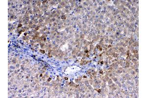 IHC analysis of CD105 using anti-CD105 antibody .