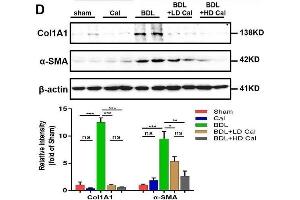 Calcipotriol alleviates BDL-induced liver injury and fibrosis. (COL1A1 抗体  (AA 100-200))