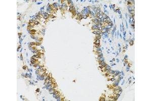 Immunohistochemistry of paraffin-embedded Rat lung using PI3 Polyclonal Antibody at dilution of 1:100 (40x lens). (PI3 抗体)