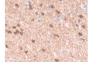 Detection of QDPR in Human Cerebrum Tissue using Polyclonal Antibody to Quinoid Dihydropteridine Reductase (QDPR) (QDPR 抗体  (AA 1-244))