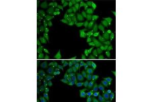 Immunofluorescence analysis of MCF7 cells using RTKN Polyclonal Antibody (Rhotekin 抗体)