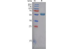 Human Protein, hFc Tag on SDS-PAGE under reducing condition.