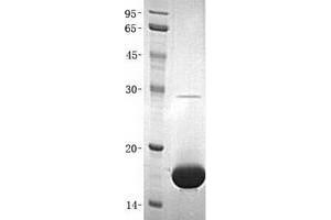 Western Blotting (WB) image for Small Ubiquitin Related Modifier 2 (SUMO2) (Transcript Variant 2) protein (His tag) (ABIN2732982)