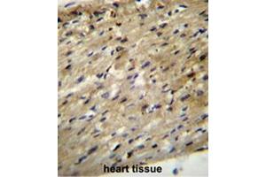 ABCD2 Antibody (C-term) immunohistochemistry analysis in formalin fixed and paraffin embedded human heart tissue followed by peroxidase conjugation of the secondary antibody and DAB staining. (Abcd2 抗体  (C-Term))
