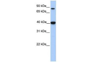 ACAT1 antibody used at 1 ug/ml to detect target protein.