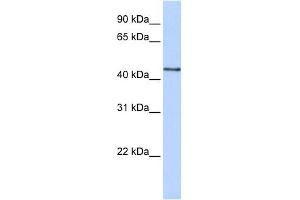 B3GNT4 antibody used at 1 ug/ml to detect target protein. (B3GNT4 抗体  (N-Term))