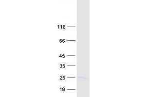 Validation with Western Blot