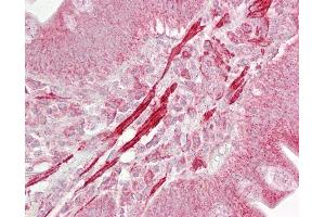 Anti-ROCK2 antibody IHC of human small intestine. (ROCK2 抗体  (AA 511-560))