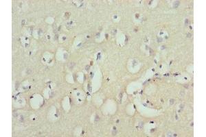 Immunohistochemistry of paraffin-embedded human brain tissue using ABIN7176132 at dilution of 1:100 (ZNF177 抗体  (AA 1-321))