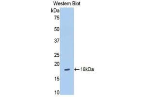 Western blot analysis of the recombinant protein. (SLIT3 抗体  (AA 35-119))