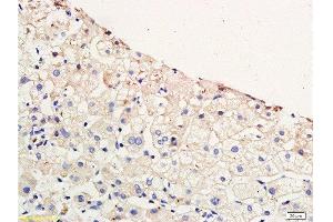 Immunohistochemistry (Paraffin-embedded Sections) (IHC (p)) image for anti-Chemokine (C-C Motif) Receptor 4 (CCR4) (AA 201-300) antibody (ABIN738666)