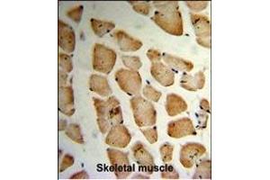 Formalin-fixed and paraffin-embedded human Skeletal muscle reacted with MVD Antibody (N-term), which was peroxidase-conjugated to the secondary antibody, followed by DAB staining. (MVD 抗体  (N-Term))