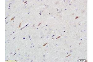 Formalin-fixed and paraffin embedded rat brain tissue labeled with Rabbit Anti-Neuroligin 1 Polyclonal Antibody  at 1:200 followed by conjugation to the secondary antibody and DAB staining. (Neuroligin 1 抗体  (AA 701-800))