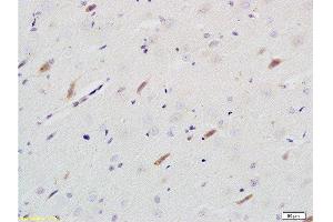 Formalin-fixed and paraffin embedded rat brain tissue labeled with Rabbit Anti-Neuroligin 1 Polyclonal Antibody  at 1:200 followed by conjugation to the secondary antibody and DAB staining.