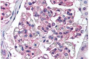 Human Kidney (formalin-fixed, paraffin-embedded) stained with PTK2B antibody ABIN239840 at 1:50 followed by biotinylated goat anti-rabbit IgG secondary antibody ABIN481713, alkaline phosphatase-streptavidin and chromogen. (PTK2B 抗体  (N-Term))