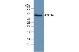 Western blot analysis of Human Uterus. (QPCT 抗体  (AA 29-361))