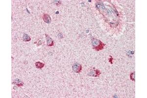 Immunohistochemistry (IHC) image for anti-Sortilin-Related Receptor, L(DLR Class) A Repeats Containing (SORL1) antibody (ABIN1724674)