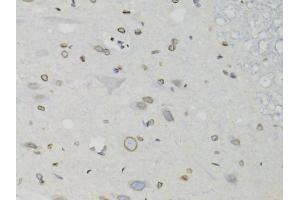 Immunohistochemistry of paraffin-embedded rat spinal cord using LMNB1 antibody (ABIN5970980) at dilution of 1/100 (40x lens). (Lamin B1 抗体)