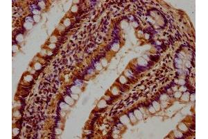 Immunohistochemistry (IHC) image for anti-ATPase, H+ Transporting, Lysosomal 42kDa, V1 Subunit C1 (ATP6V1C1) (AA 129-382) antibody (ABIN7175232)