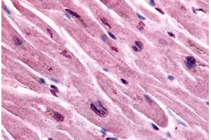 Human Heart (formalin-fixed, paraffin-embedded) stained with CHRM3 antibody ABIN213346 at 10 ug/ml followed by biotinylated goat anti-rabbit IgG secondary antibody ABIN481713, alkaline phosphatase-streptavidin and chromogen. (CHRM3 抗体  (Cytoplasmic Domain))