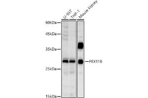 Western blot analysis of extracts of various cell lines, using PEX11B antibody (ABIN7269244) at 1:1000 dilution. (PEX11B 抗体)