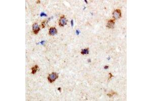 Immunohistochemistry (IHC) image for anti-Protein Phosphatase 1, Regulatory (Inhibitor) Subunit 14A (PPP1R14A) (N-Term), (pSer38) antibody (ABIN7303852)