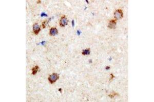 Immunohistochemical analysis of CPI17 (pT38) staining in human brain formalin fixed paraffin embedded tissue section. (CPI-17 抗体  (N-Term, pSer38))