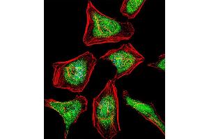 Fluorescent confocal image of Hela cell stained with ATF7 Antibody (N-term) (ABIN1881079 and ABIN2842518). (ATF7 抗体  (N-Term))