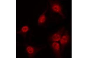 ABIN6267539 staining 293 by IF/ICC. (SOX9 抗体  (pSer181))