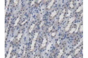 DAB staining on IHC-P; Samples: Mouse Kidney Tissue (UMPS 抗体  (AA 311-481))