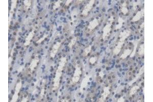DAB staining on IHC-P; Samples: Mouse Kidney Tissue