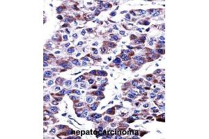 Immunohistochemistry (IHC) image for anti-Dual Specificity Phosphatase 9 (DUSP9) antibody (ABIN2997604) (DUSP9 抗体)